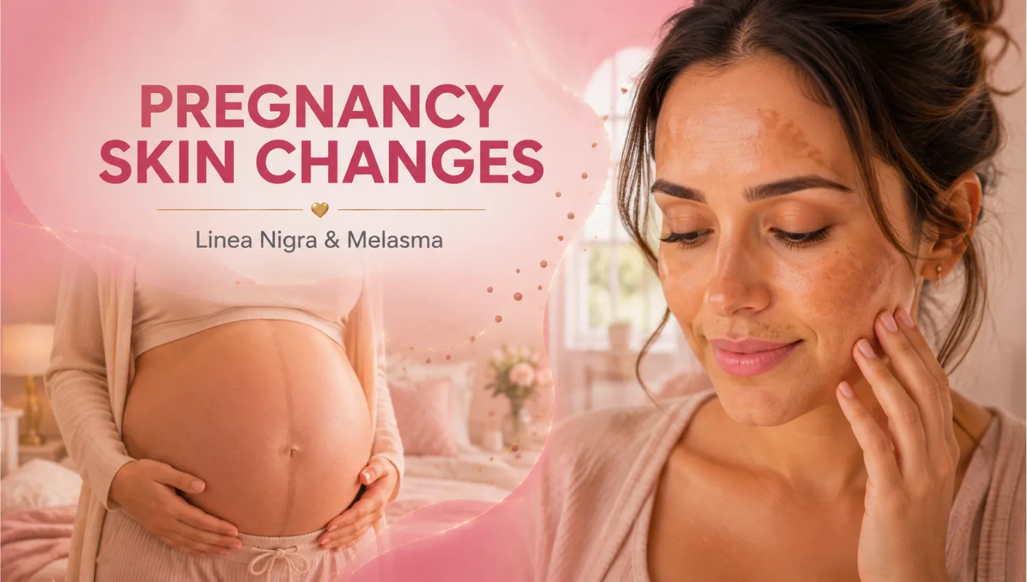 Pregnant woman showing linea nigra on the abdomen and melasma on the face.